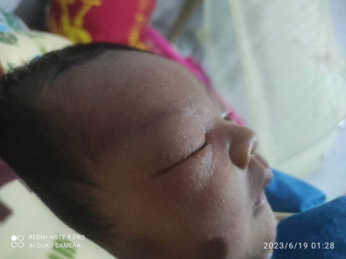 Muncul bintik bintik kecil di area wajah