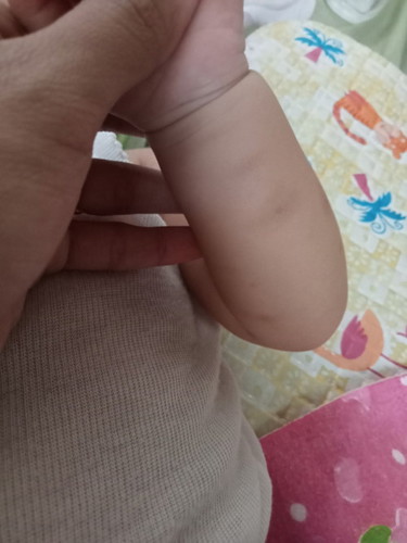 Bekas nyamuk