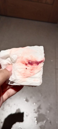 Ini normal tdk ya? Sya tkut usia kandungan baru 22week... Ada yg pernah mengalami kah...