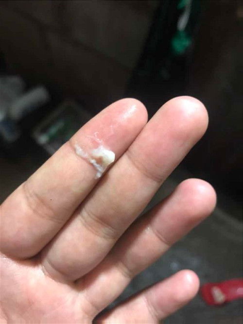 อันนี้ใช่มูกใสไหมคะ