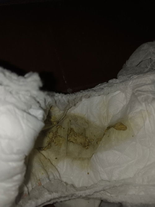 Bayi umur 6 bulan feses nya 5 kali sehari, berwarna kuning, berlendir tapi ada ampasnya