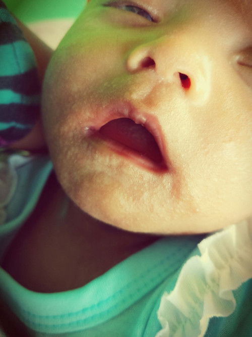 Obatnya apa ya bunda