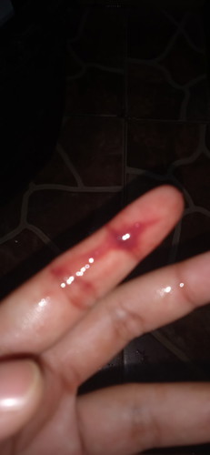APA INI DARAH IMPLANTASI