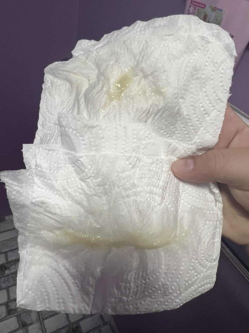 มูกแบบนี้คืออะไรตะแม่ๆ