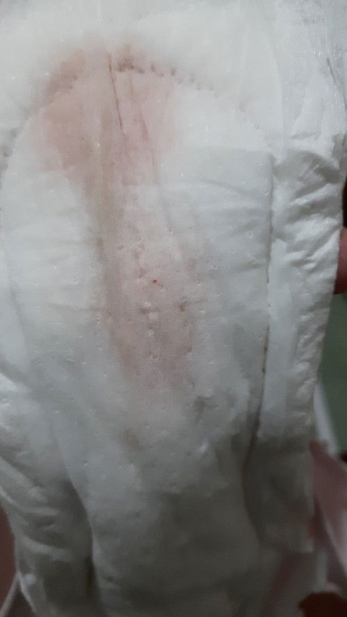 Bund, UK 38w tbtb keluar cairan seperti ini knpa yaa? Bentuknya cair bukan lendir 🙏🙏