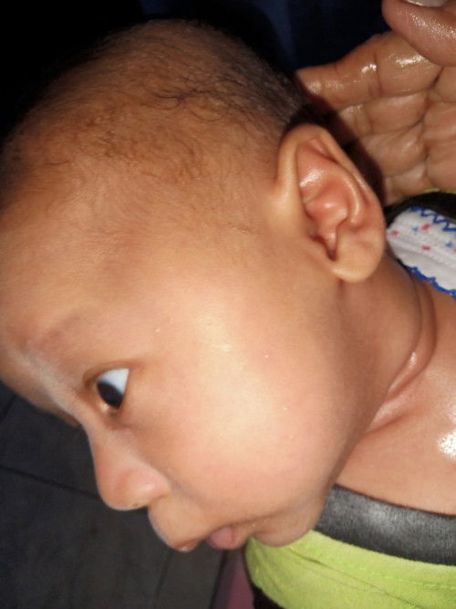 Bruntusan putih2 diwajah