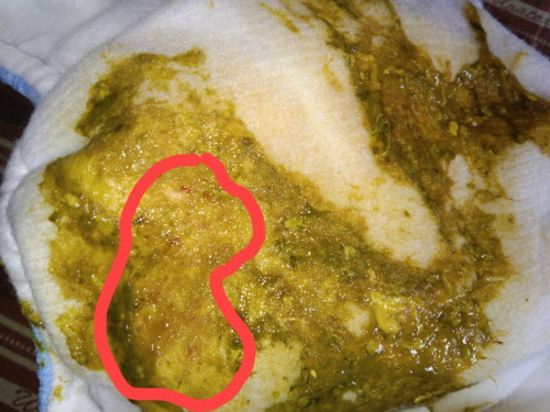 Greenish with blood stains on baby's POOP!