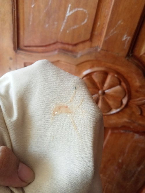 Ilang days bago kayo manganak MGA momshie? Ganyan palang naman kaunti Yung sakin ngayong morning 37w