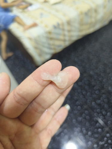 เมือกขาวขุ่นๆ