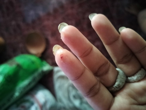 มีลิ่มเลือดออกจิ๊ดนึงตอนตื่นนอนเพราะอั้นปัสสาวะ