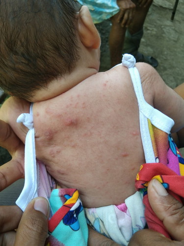 Ano ang dapat gawin kapag inuubo si baby 2 months old po yung baby ko