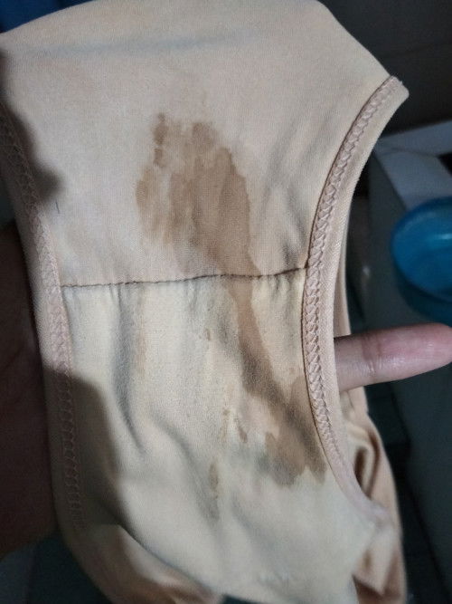 37+3เหมือนมีเลือดออก