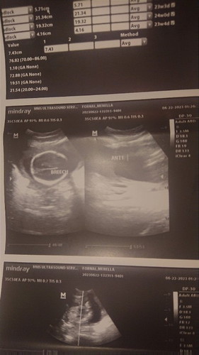 ultrasound?