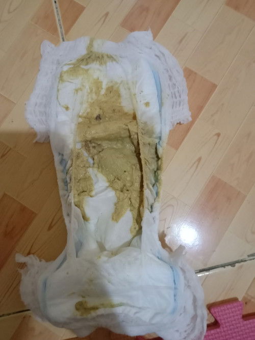 Nag aalala ako sa poop ni baby