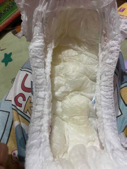 ทารกฉี่เหลืองอ่อนๆ ขาดน้ำ?