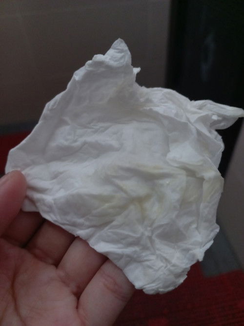 Keputihan UK 35-36 minggu