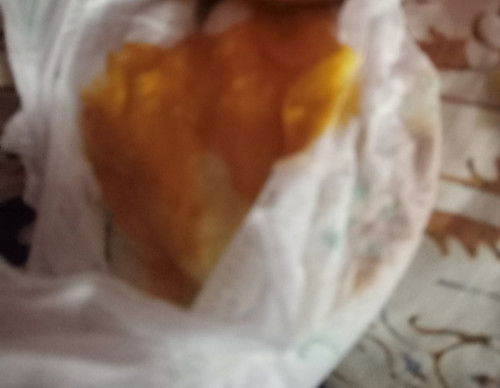 bab cair dan kayak berlendir dan agak sering