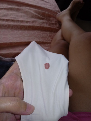 Normal po ba na may pumatak na dugo sakin 5 months pregnant po ako