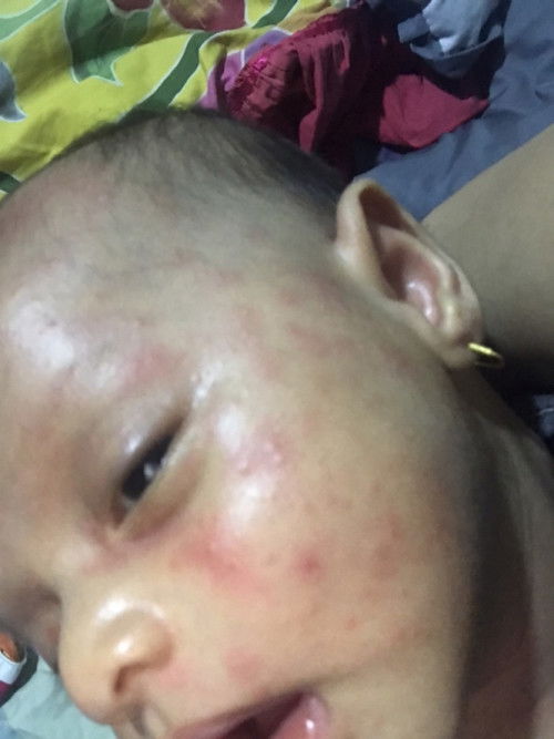 muka bayi merah merah