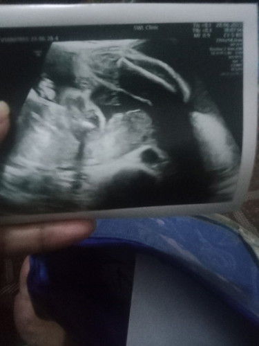 อยากรุ้ว่าดูตรงหนัยคะ ถึงรุ้ว่า ผญ