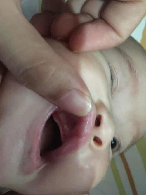 Teething na po ba to?