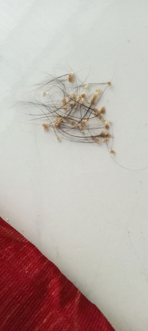 Cứt trâu phải làm sao