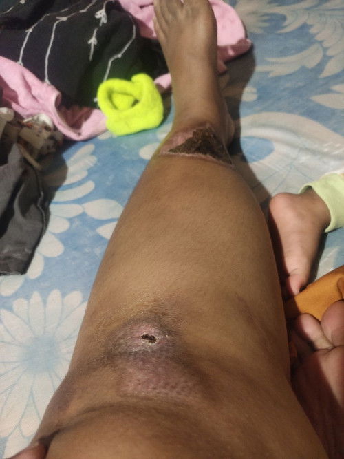 Minta Tolong Bun say