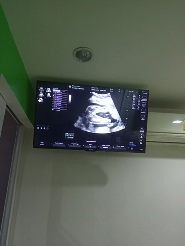 ได้ลูกสาวสมใจ