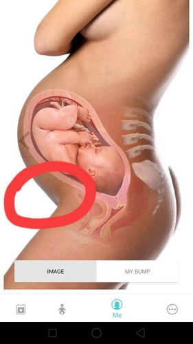 bersalin normal