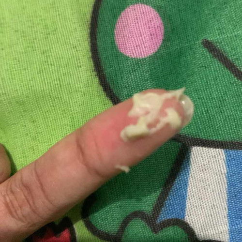 keluar keputihan di usia 28weeks 2hari