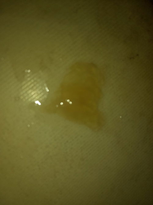 Usia kandungan 37week 3 day