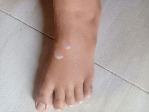 Keluar cairan putih🥲