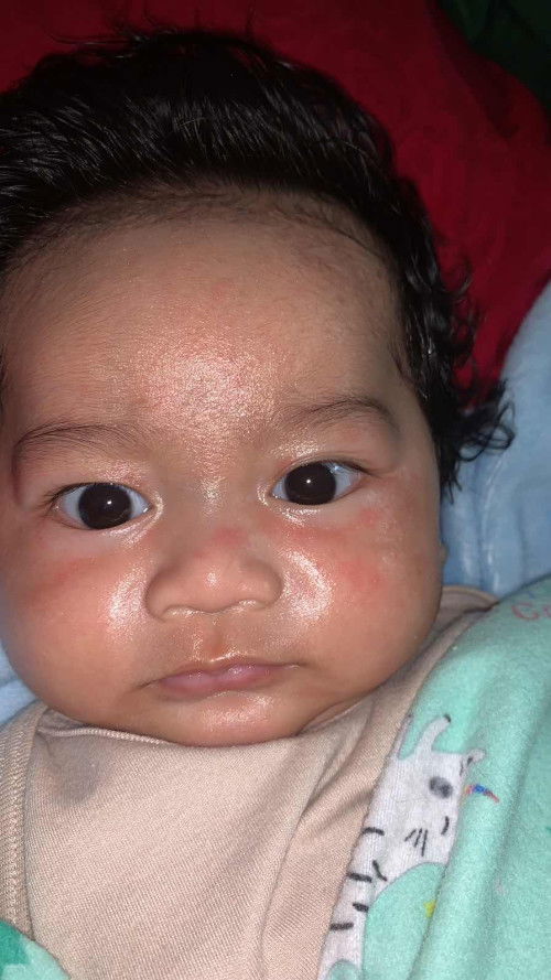 Bintik merah di bagian pipi