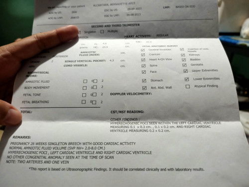 Hyperechogenic Foci : CAS Ultrasound