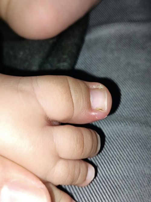 Jari kaki bayi cantengan?