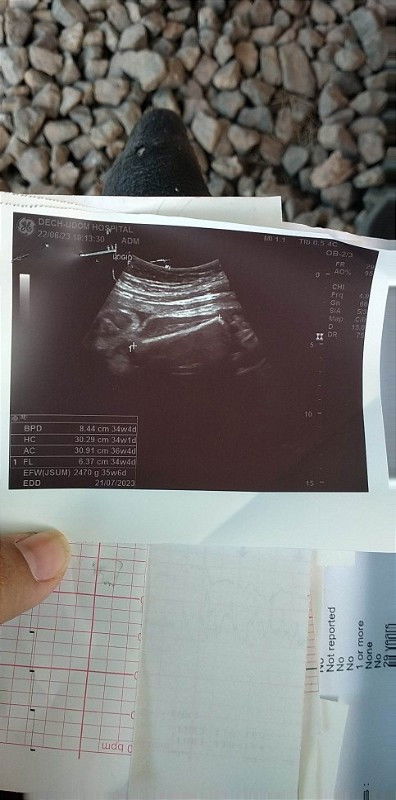 แม่อายุครรภ์กี่สัปดาห์แล้วคะ