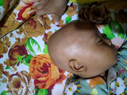 Bentuk kepala seperti ini normal kah?