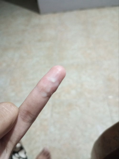 Keputihan kehamilan  30wekk normal ngga sih bun ???? Maap sedikit jorok