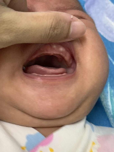 Assalamulaikum.anak sy baru 1 bulan 21 hari. sy baru perasan ada biji putih di gusi anak sy. knp ye?