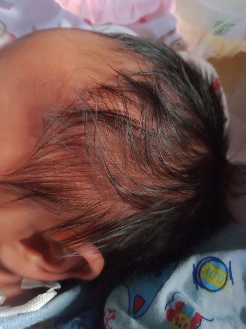 ลูกมีตุ่มใสๆขึ้น