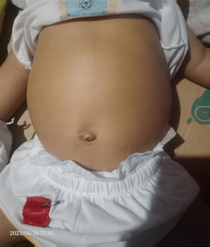 Laki ng tiyan ni baby 2months old normal lang po ba