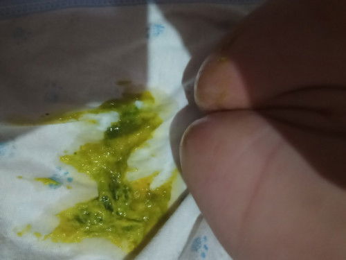 PUP BAYI 2BULAN 11HARI