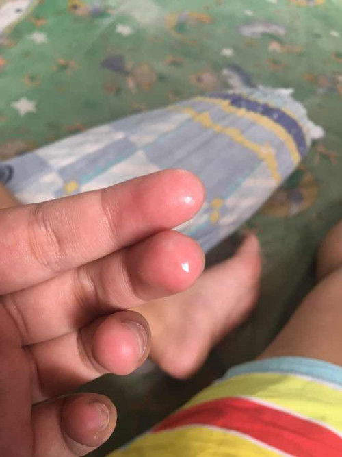 มีน้ำใสๆปนสีขาวขุ่น