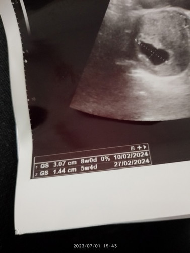 Nk tanya... usia kandungan ikut dlm gambar scan ni ke...
