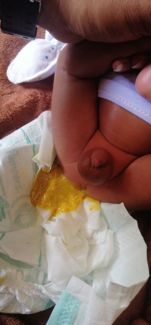 Baby Poop for Formula Fed