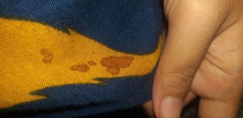 Asi merembes/atau tidak