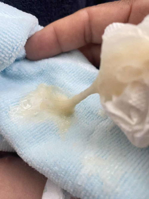 อยากทราบว่า คือปกติหรือไม่ปกติ