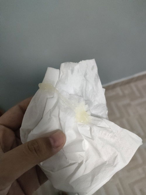 มีมูกออกมาแบบนี้ ทัอง39วีค