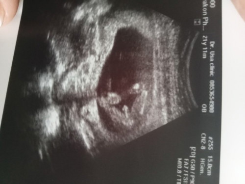 แม่ๆบ้านไหนรู้เพศกันบ้างแล้วคะ