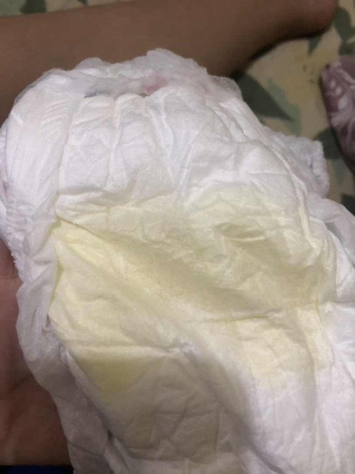 Air kencing bayi 10 bulan